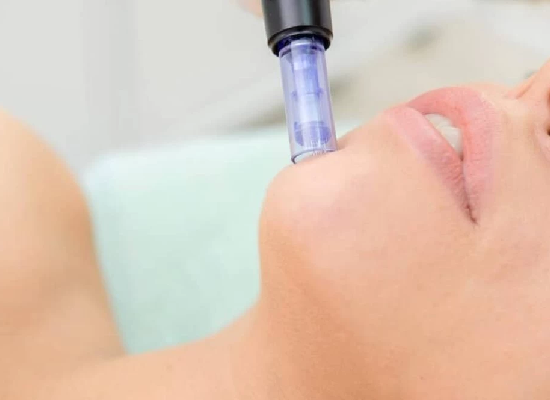 Collagen Pin Microneedling with HA